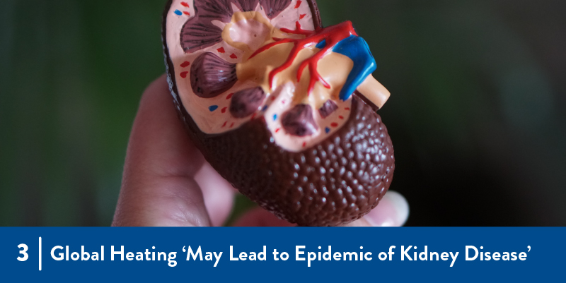 A model of a kidney